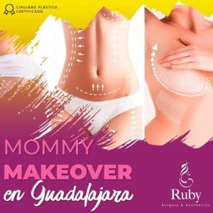Mommy Makeover en Guadalajara 